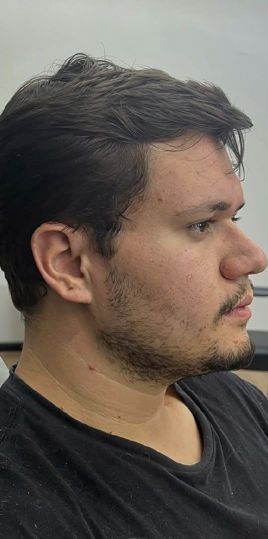 Antes da transformação do cliente 2