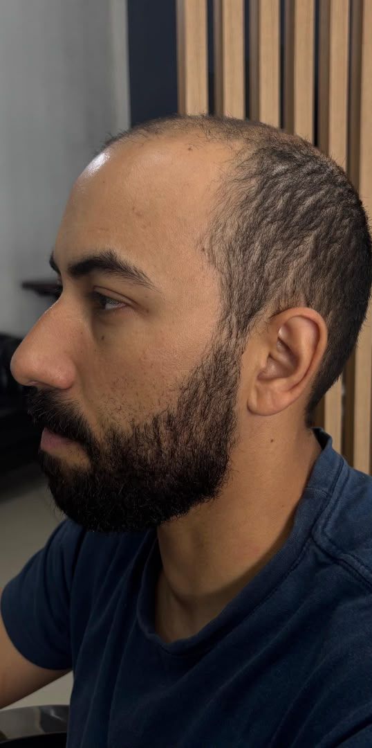 Antes da transformação do cliente 4
